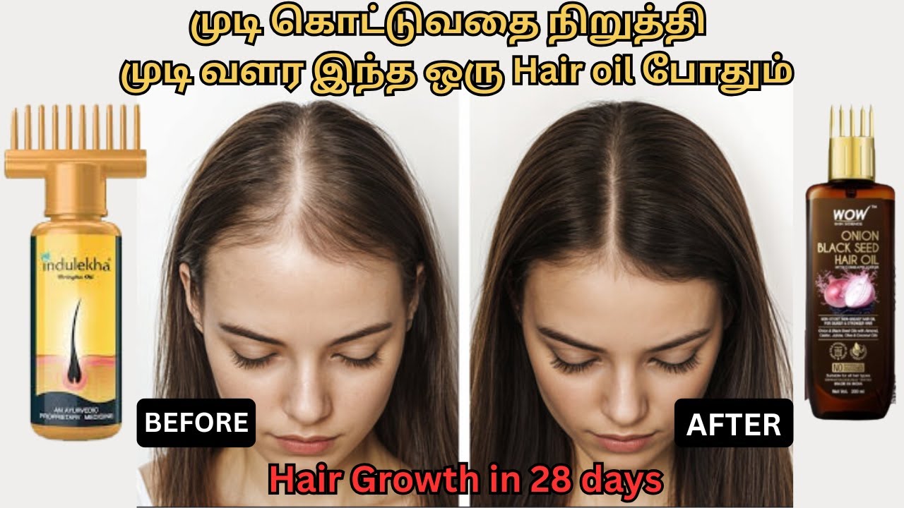 முடி கொட்டுவதை நிறுத்தி முடி வளர இந்த ஒரு Hair oil போதும் | Hair Growth in 28 days| Indulekha vs WOW