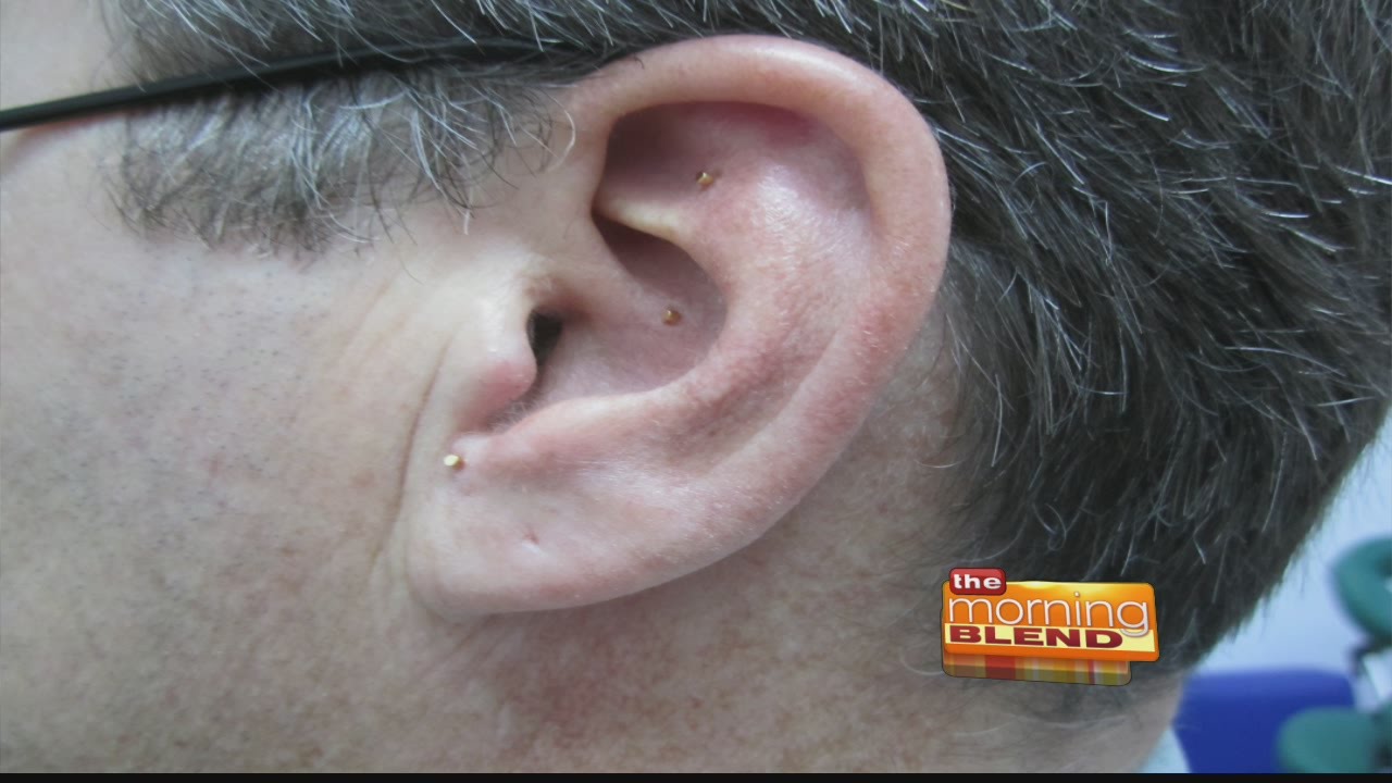 Rainbow Bridge Healing Arts - battlefield acupuncture