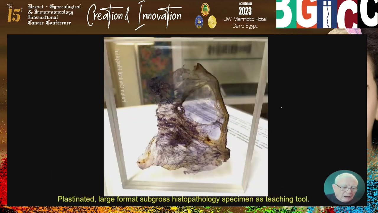 Histopathology for the radiologists by Prof  Laszlo Tabar 1