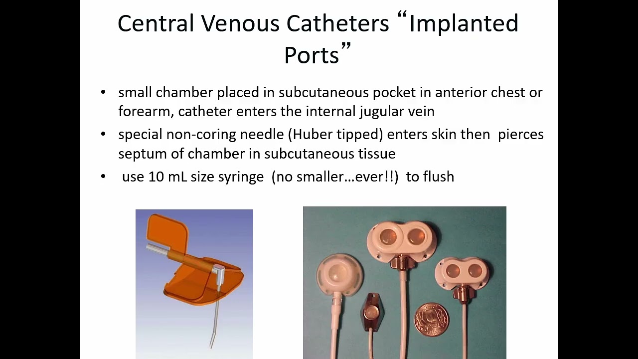 Central venous catheters