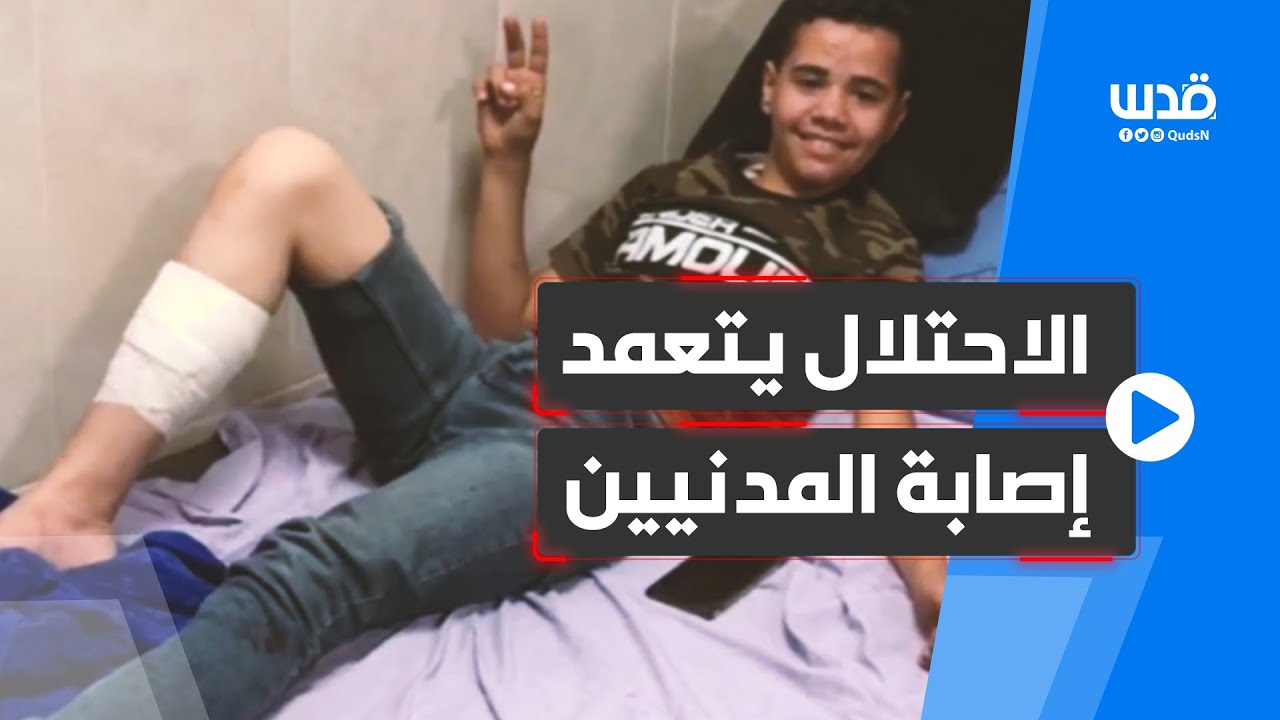 الاحتلال يتعمد إصابة المدنيين الفلسطينيين بالرصاص في قراوة بني حسان غرب سلفيت