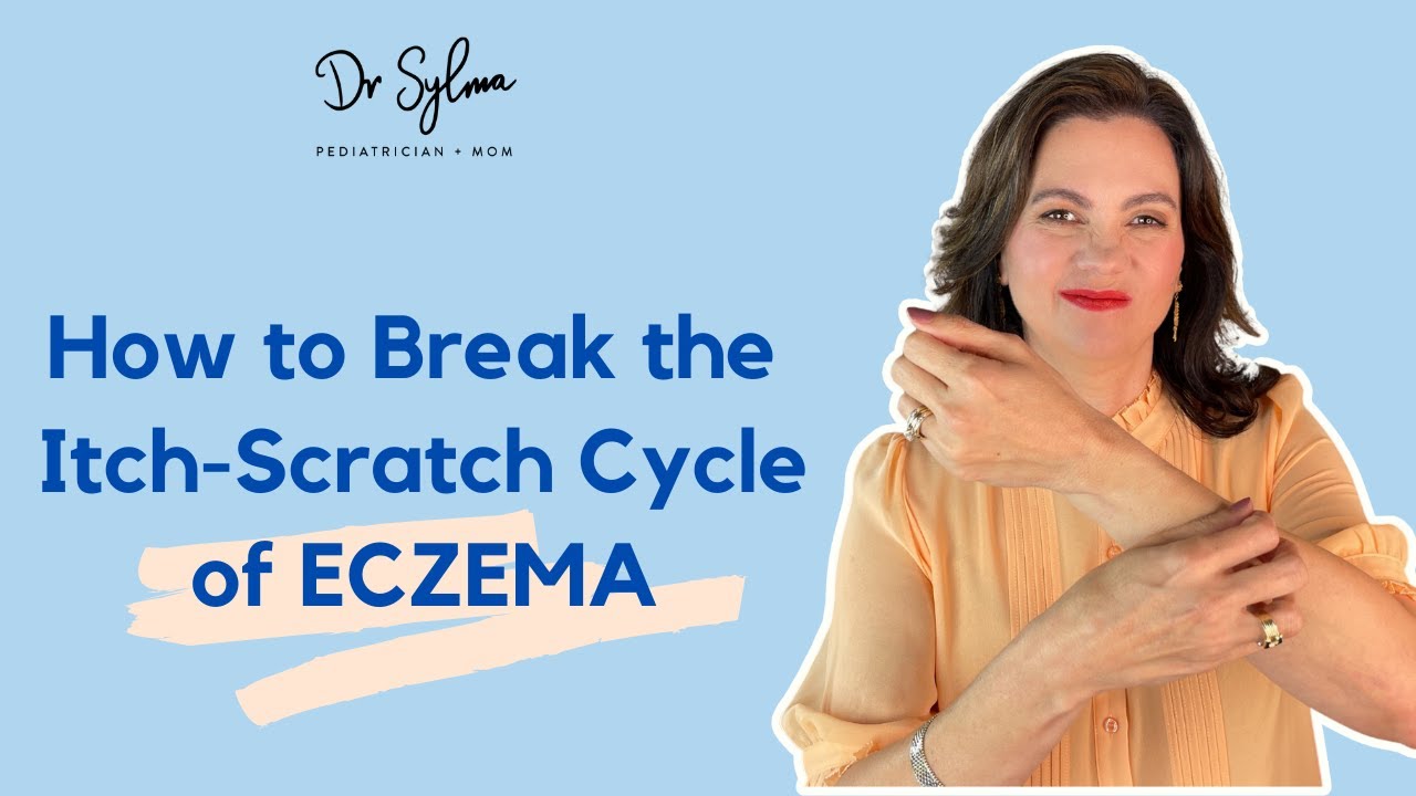 How to Break the Itch-Scratch Cycle of Eczema | Dr Sylma