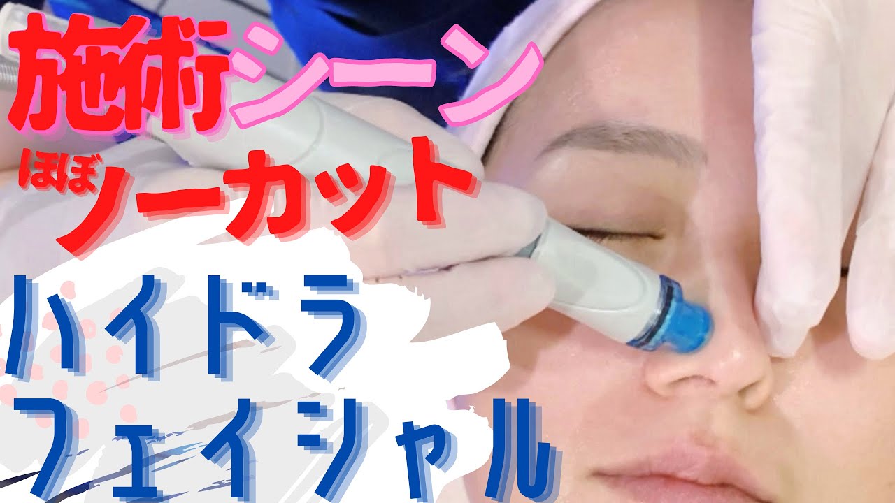 【施術シーンほぼノーカット】いちご鼻から皮脂がゴッソリ！ハイドラフェイシャルで角栓角質大掃除したら驚きの結果！【美肌ピーリング】