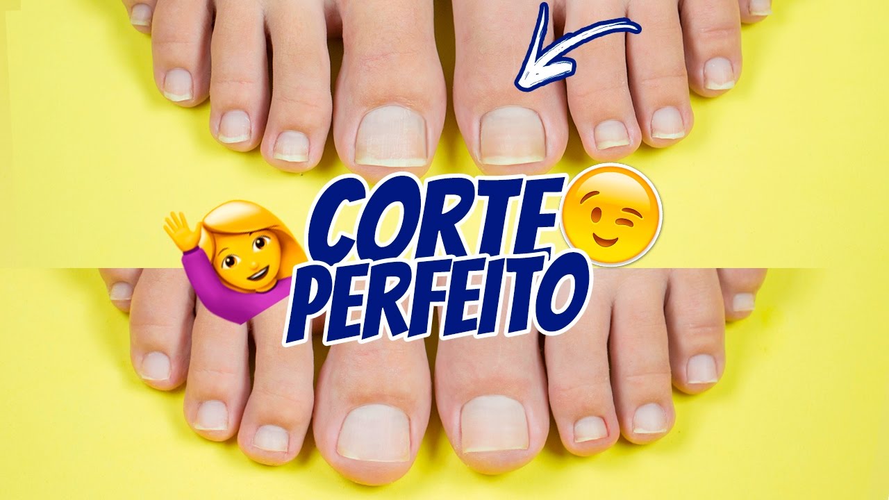 COMO CORTAR AS UNHAS DOS PÉS CORRETAMENTE - Ideia Rosa
