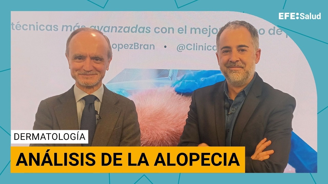 ¿Qué alopecia será la némesis de tu juventud?