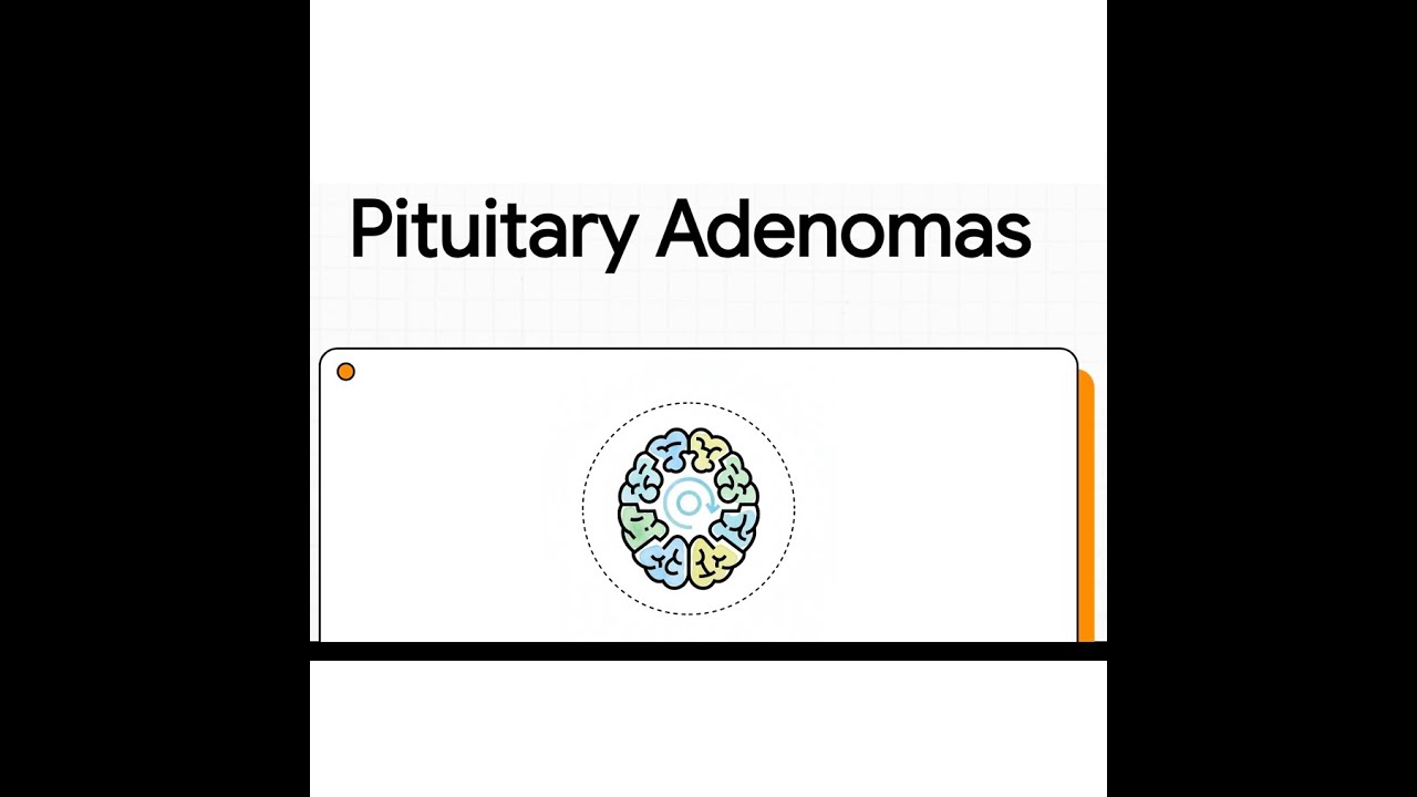 Pituitary Adenomas | Clinical Features, Diagnosis & Management Explained