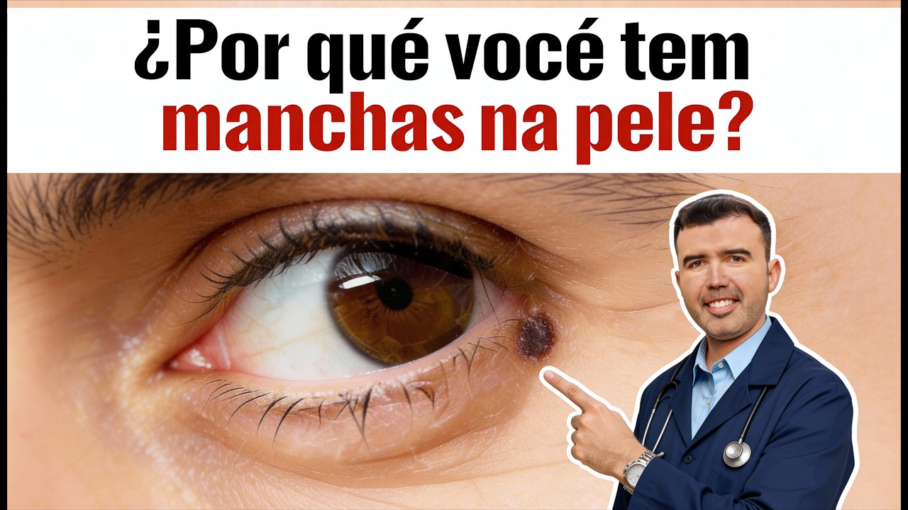 🔥 PELE Com MANCHAS? 5 Doenças Que Se Manifestam Assim + Solução Natural (Potente)