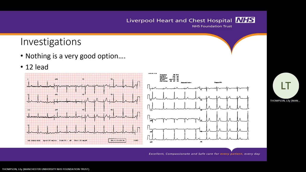 Palpitations in Pregnancy   Dr Reza Ashrafi