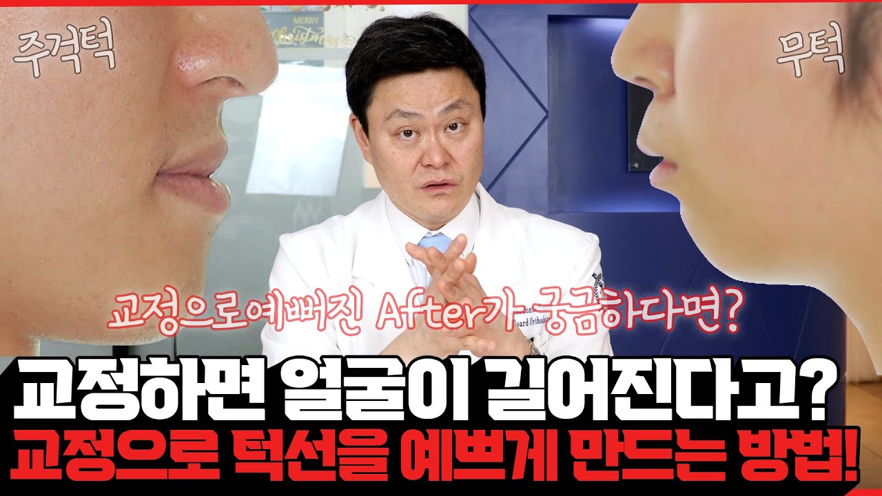 [교정일타 허원장] 치아교정한다고 턱/인중/얼굴이 길어지지 않아요! 교정이 고민된다면 이 영상 필수시청!