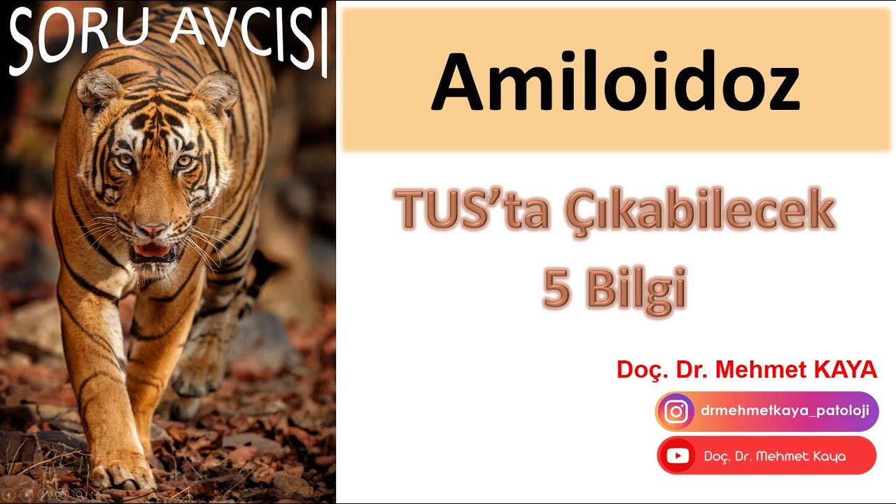 Soru Avcısı Serisi - Amiloidoz ile İlgili TUS'ta &Ccedil;ıkabilecek 5 Bilgi