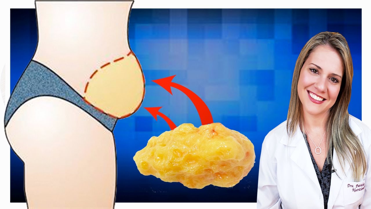 Como Queimar Gordura Sem Fazer Exercícios [EMAGRECER e PERDER MEDIDAS]