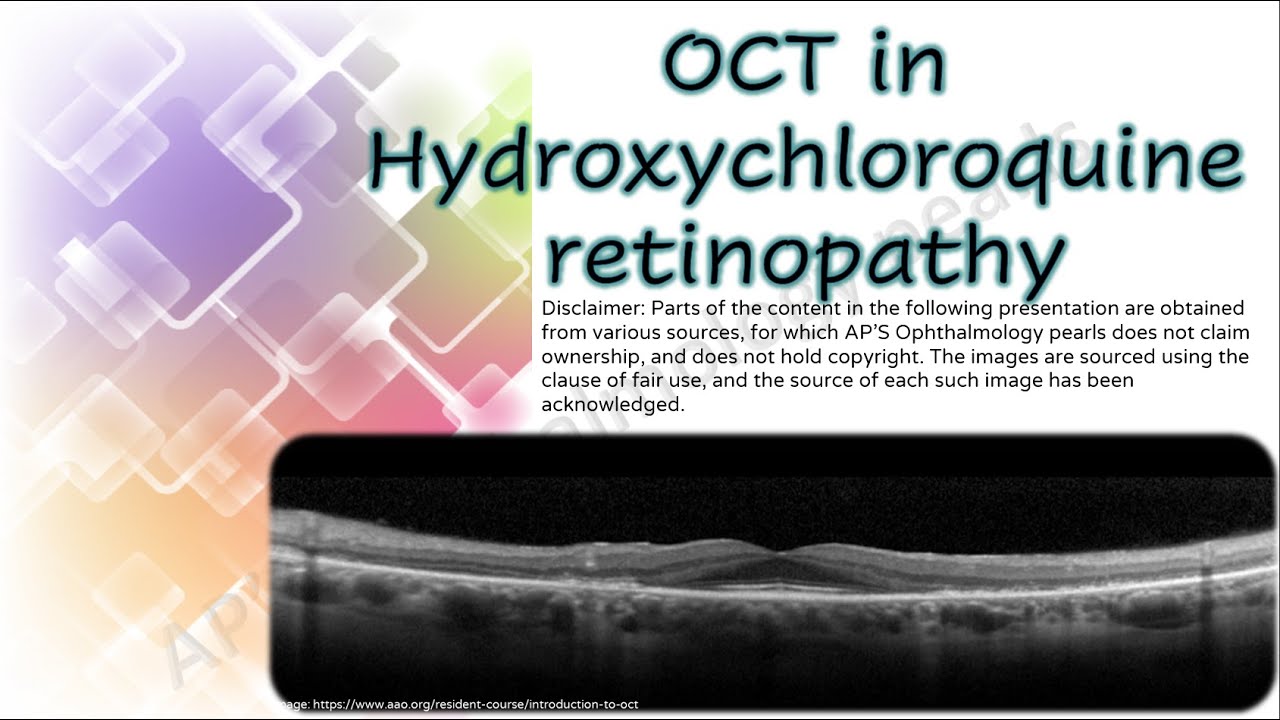 OCT 3 | OCT in hydroxychloroquine retinopathy