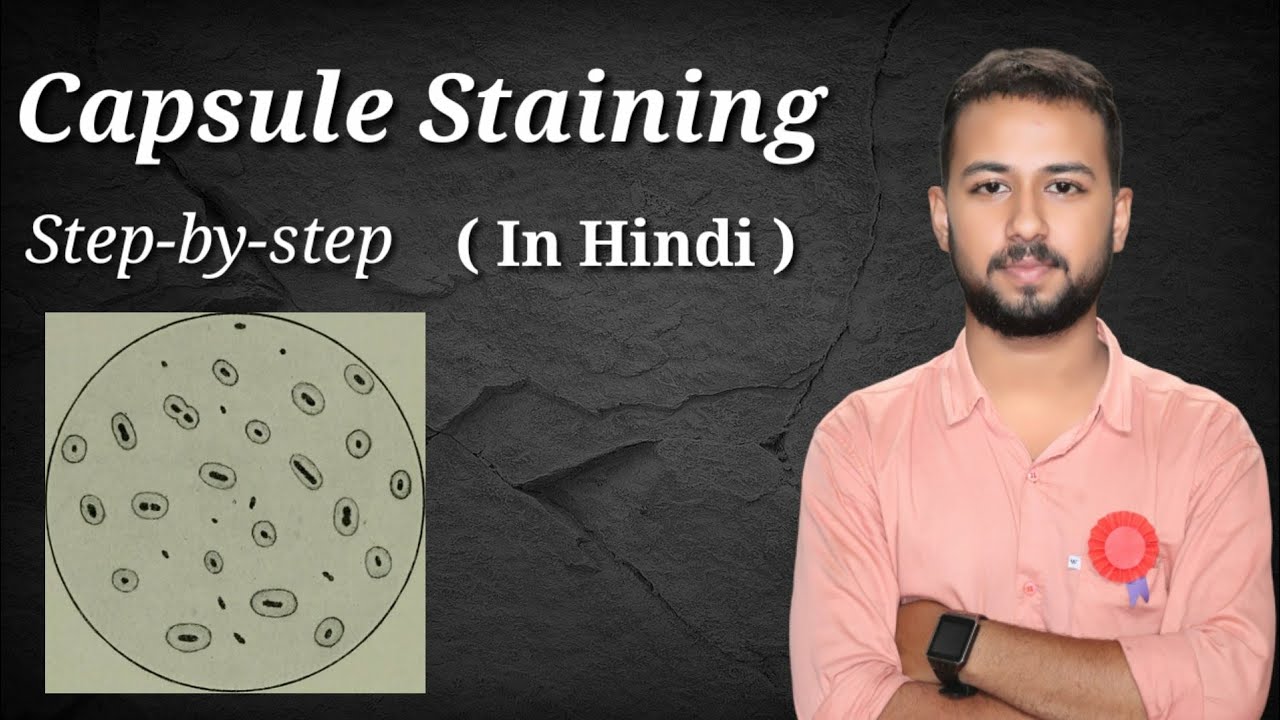 capsule staining procedure in Hindi | Anthony's capsule stain method | capsule staining microbiology