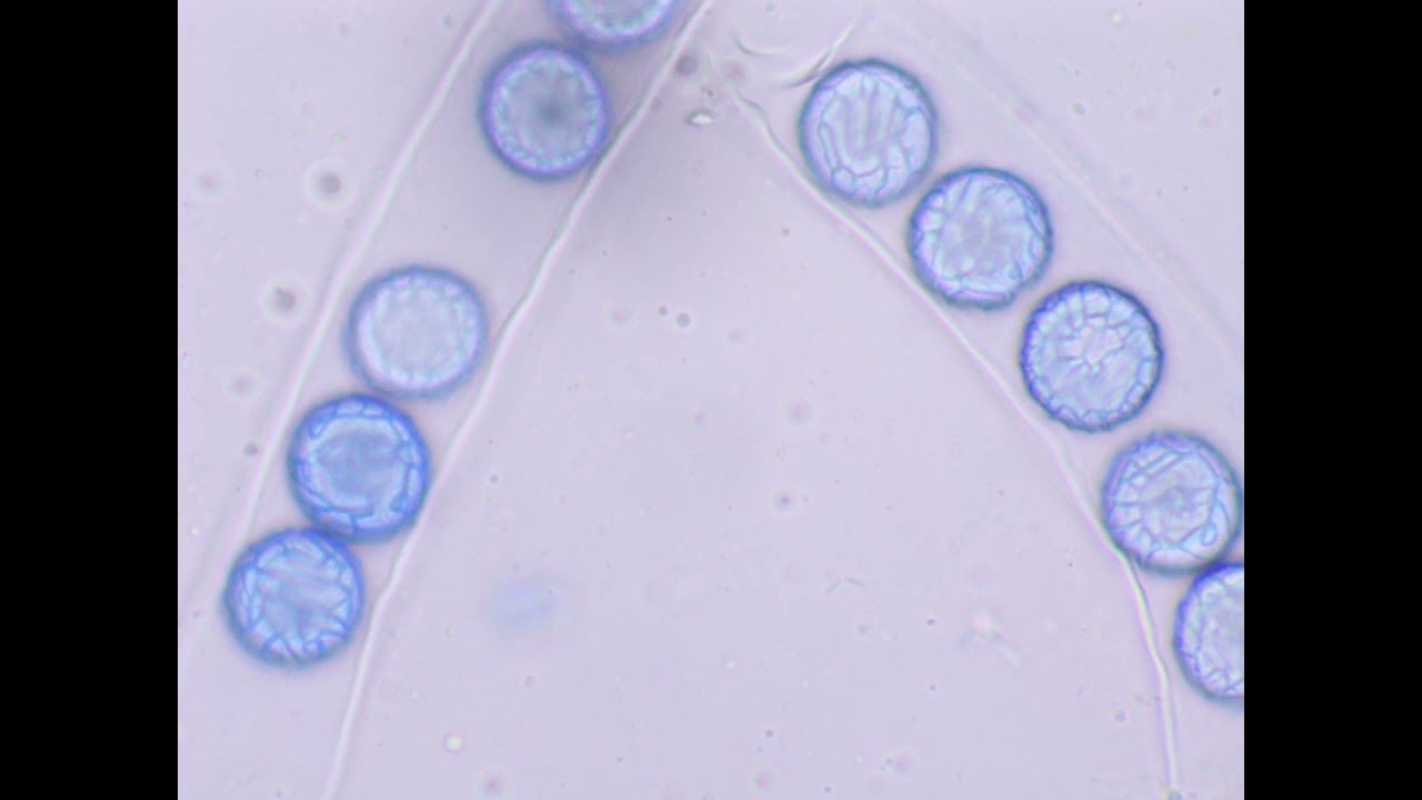 Lamprospora seaveri - ascospores stained with cotton blue
