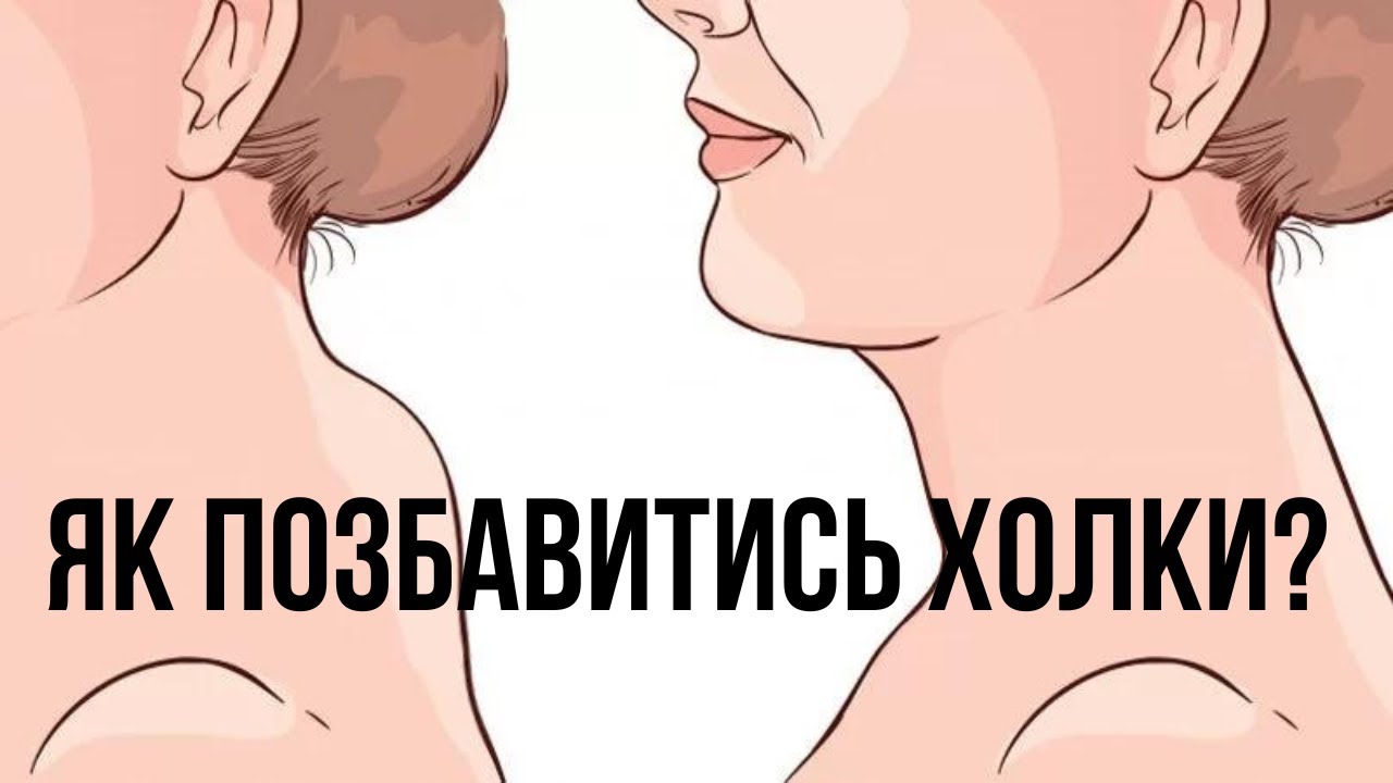 ЯК ПОЗБАВИТИСЬ ХОЛКИ (ВДОВИНОГО ГОРБА)? 5 найкращих вправ для вирішення цієї проблеми