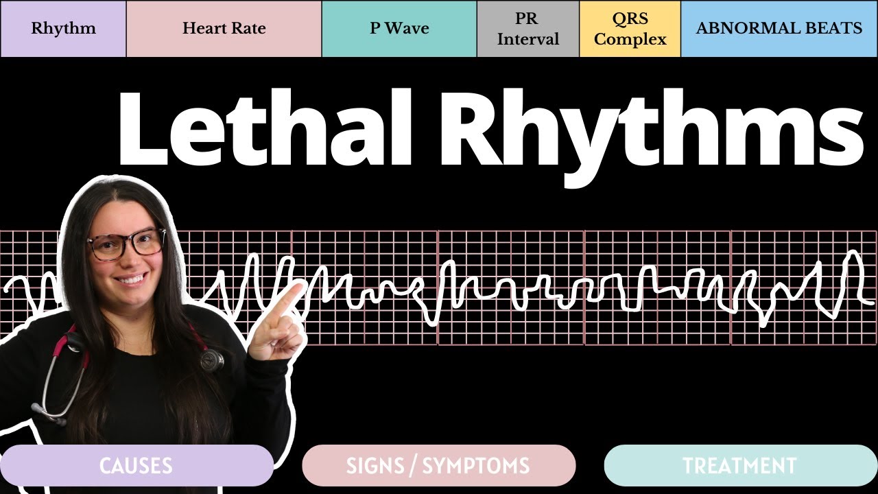 Lethal Rhythms on an EKG with Qs | Circulatory System and Disease | NCLEX-RN | Nurse Cheung