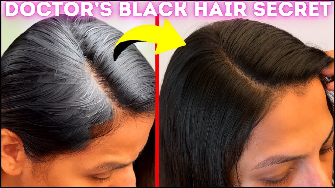 Get Permanent Result: No Dye, No Indigo Use This To Turn Premature White Hairs Black | Dr Madiha