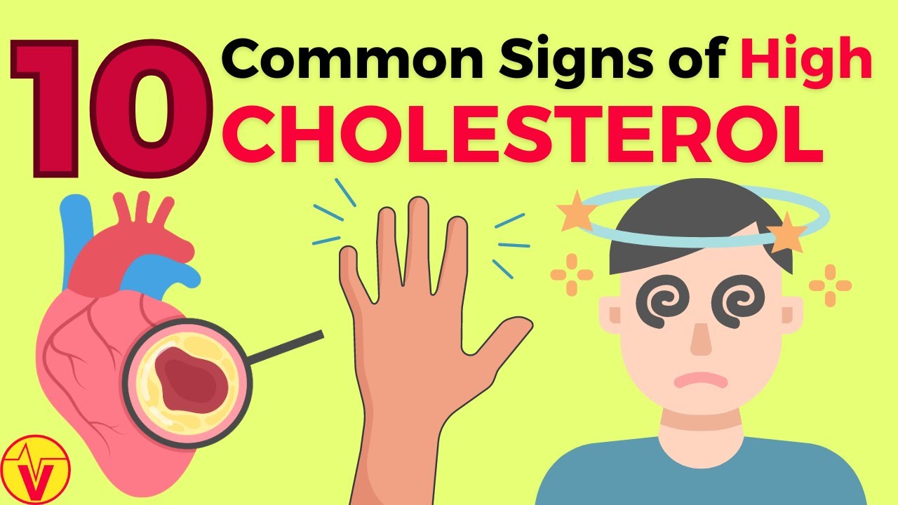 10 Common Signs of High CHOLESTEROL You SHOULD NOT Ignore | VisitJoy