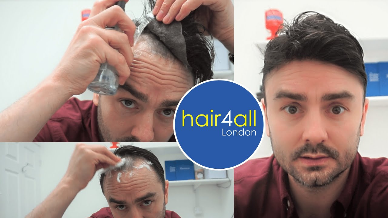 How To Remove & Reapply | Hair System | Non-Surgical Hair Replacement System for Men/Women | UK/USA