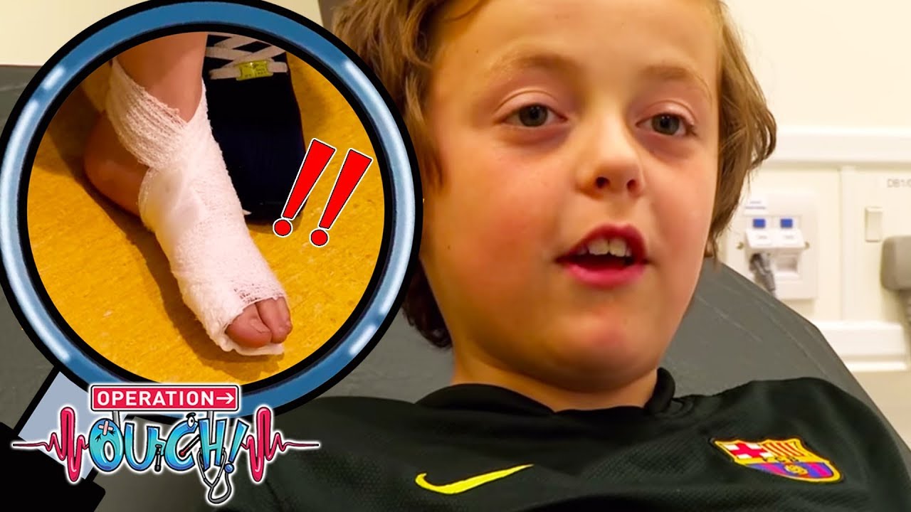 I Stepped on a Tin Lid | Operation Ouch | Science for Kids
