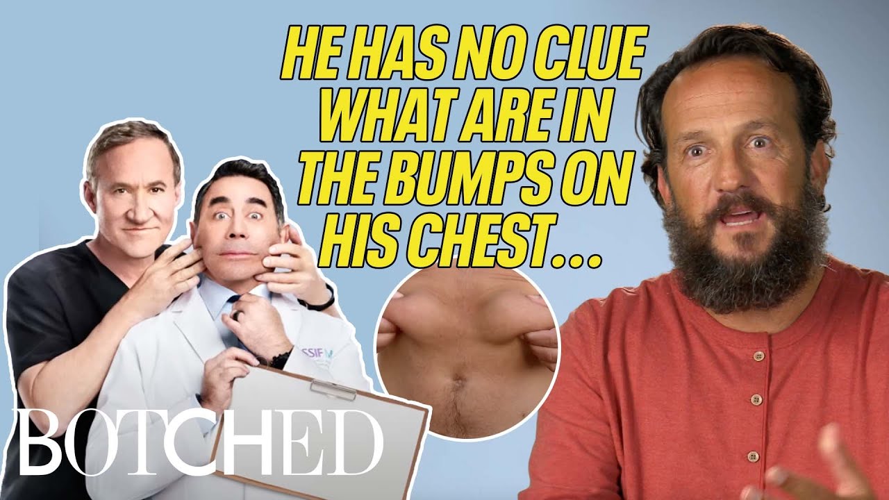 Bruno Has MYSTERY Lumps On His Chest?! (Before & After) | Botched | E!