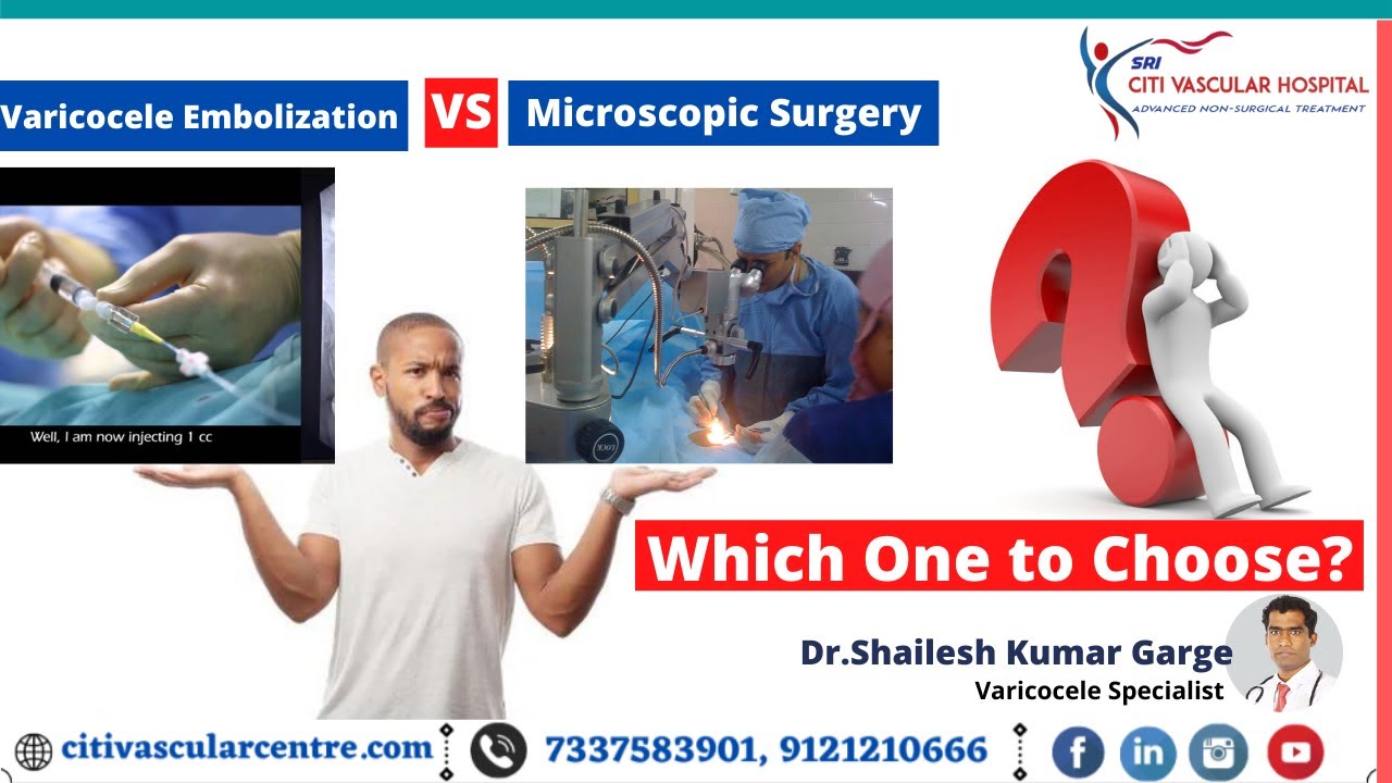Varicocele Best Treatment | Embolization OR Microsurgery? | Which One To Choose | Telugu