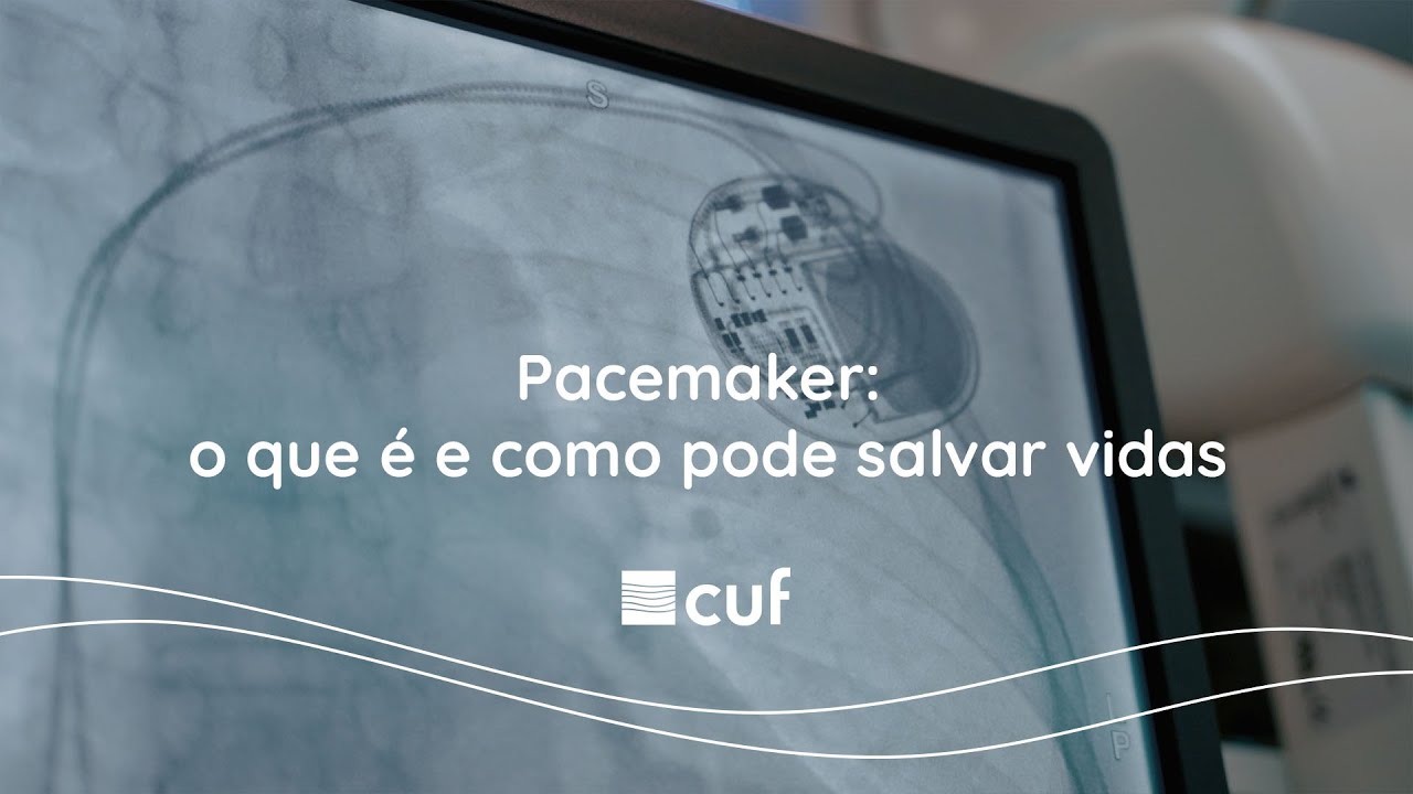 Pacemaker: o que é e como pode salvar vidas | CUF