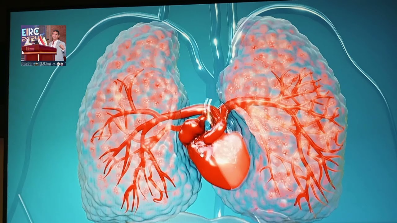 اهم المناطق التي تستخدم في حقن الصبغه بالاشعه المقطعيه شير ولايك وكومنت لدعمنا لنشر المزيد  #CT #MR