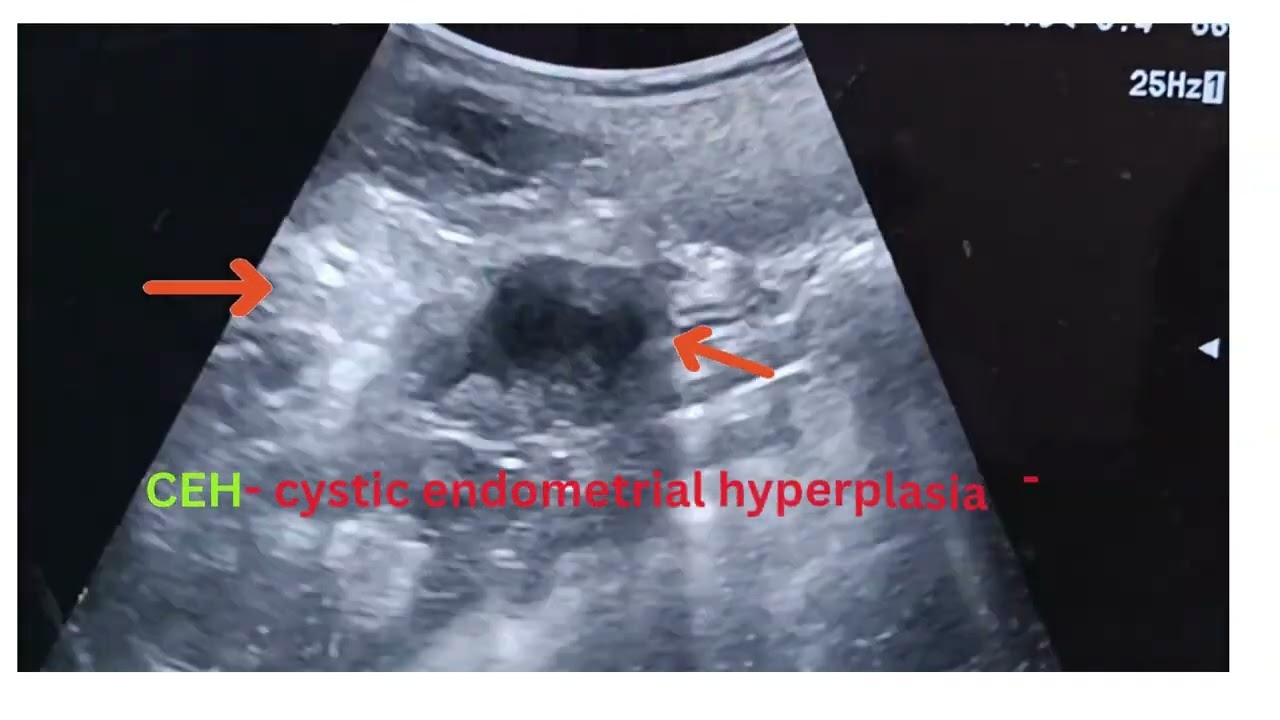 PYOMETRA  DOG
