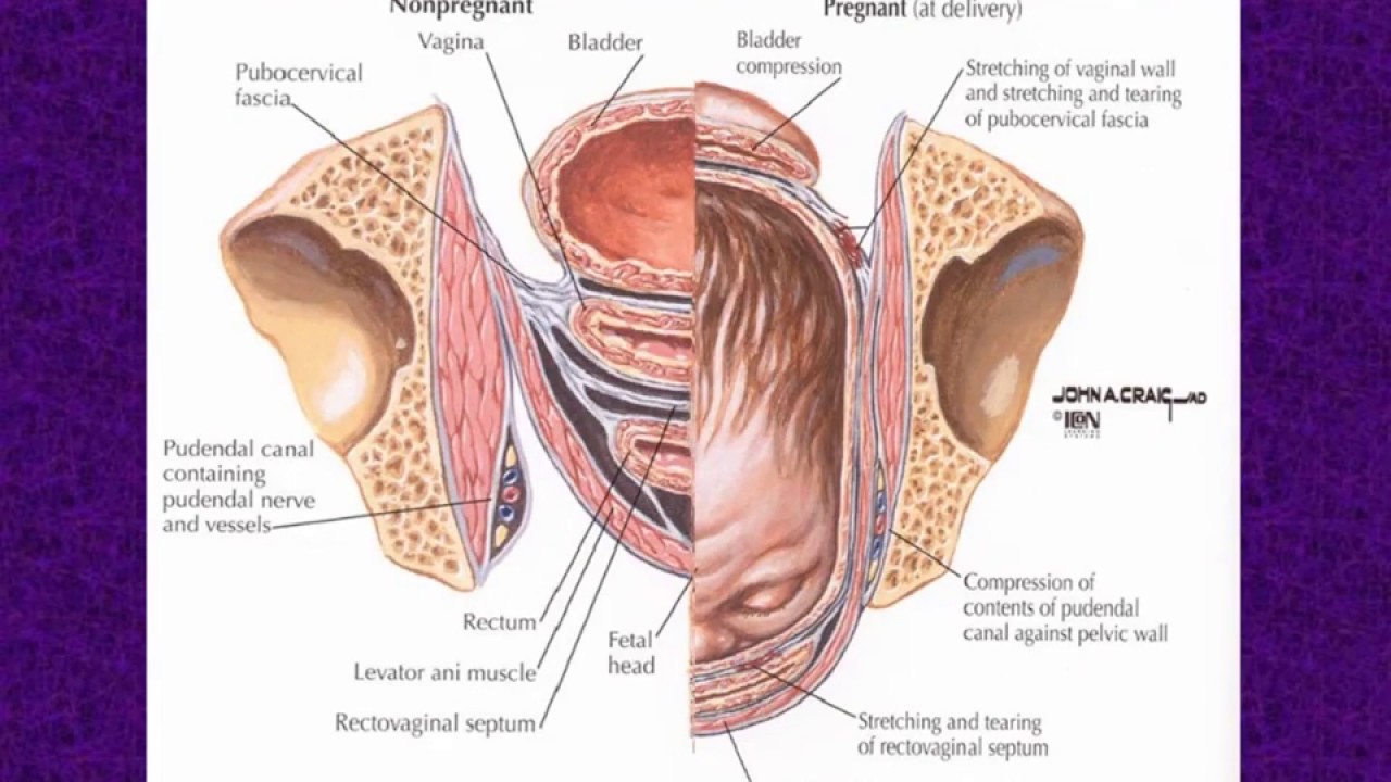 Biomechanics of Childbirth: Insights into Pelvic Floor Disorders - 1