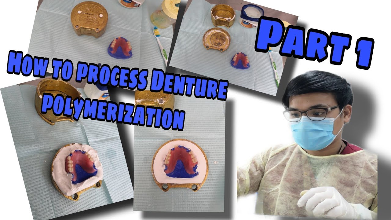 How to process Denture polymerization Part 1