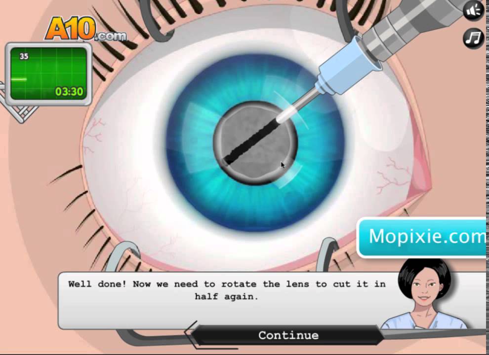 OPERATE NOW : EYE SURGERY | PLAY EYE SURGERY GAME ONLINE