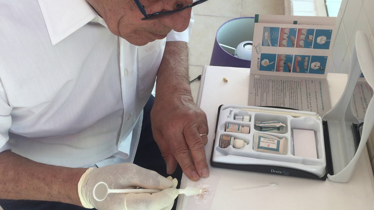 Comment recoller sa couronne dentaire ? Video d'un utilisateur. Bravo !