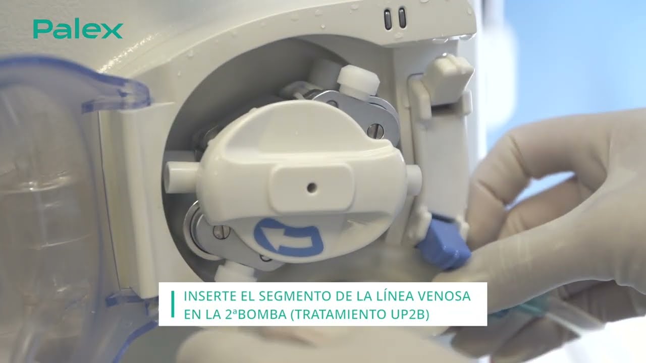 15 Tratamiento en unipunción 2 bombas TUTORIAL Nikkiso DBB EXA
