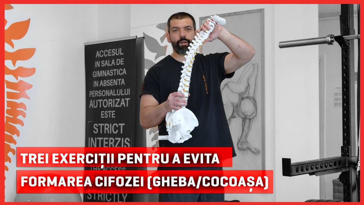 Top 3 exercitii pentru a evita formarea cifozei (gheba/cocoasa) | Alta Terapia - Andrei Simion