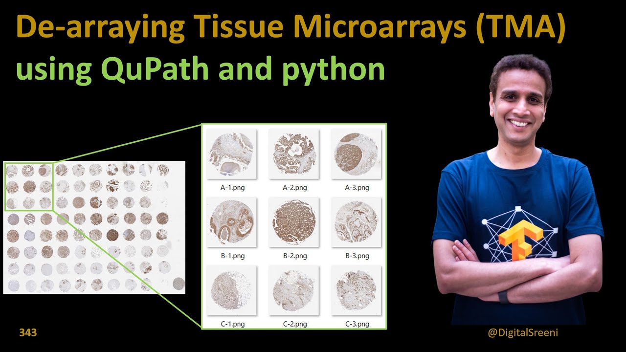 343 De-arraying Tissue Microarrays (TMA) using Qupath and python code