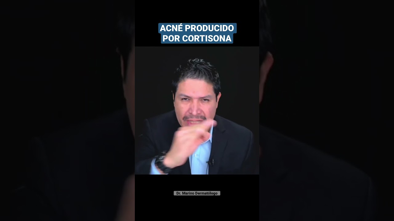 3 FORMAS DE PRODUCIR ACN&Eacute; POR USO DE CORTISONA