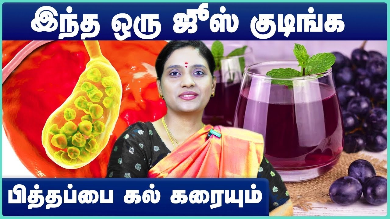 பித்தப்பை கல் குணமாக | how to cure gallbladder stones in tamil | gallbladder stones symptoms