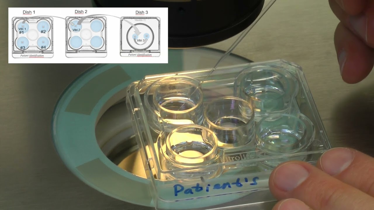 How to vitrify several blastocysts simultaneously