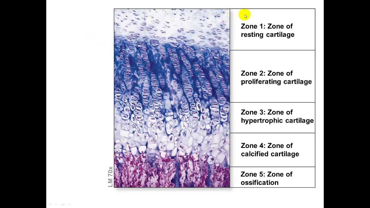 Bone Growth and Remodeling: Appositional and Interstitial Growth