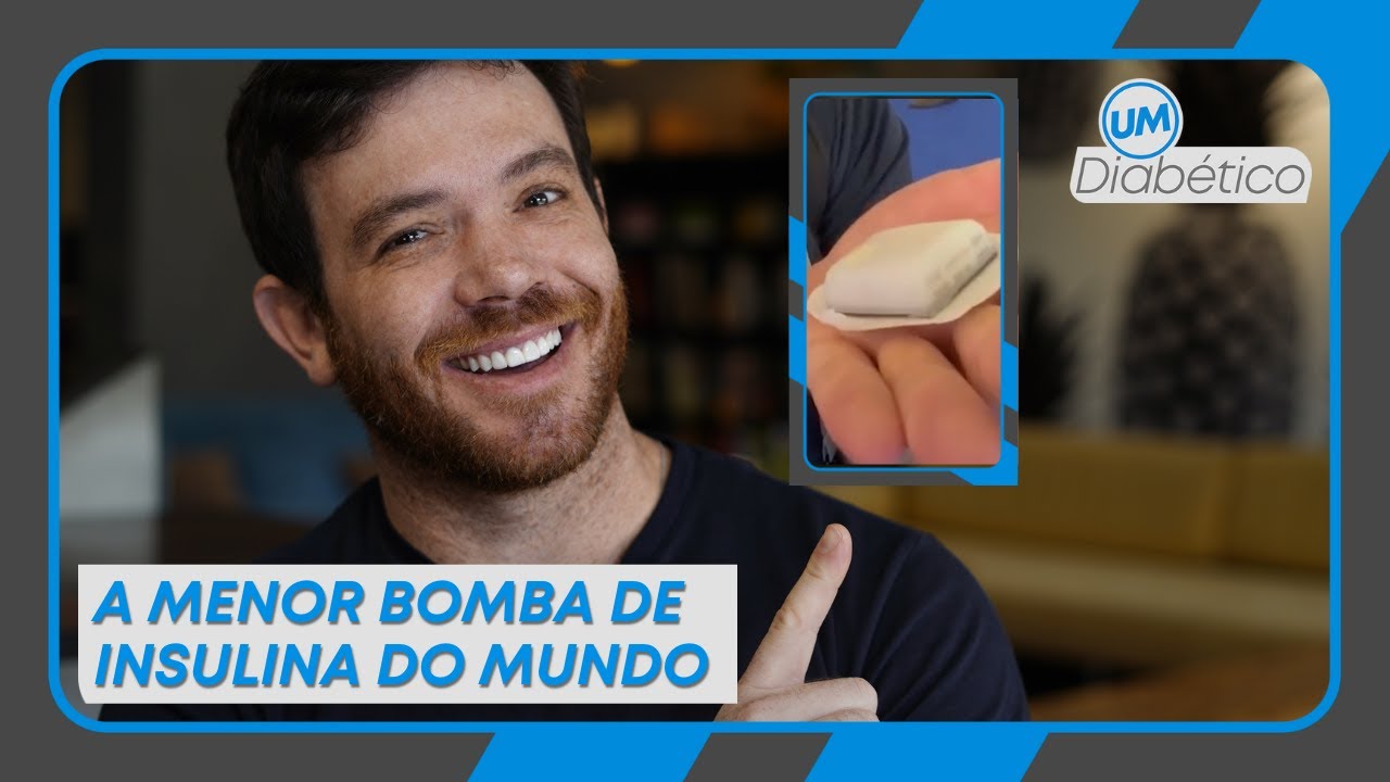 A menor bomba de insulina do MUNDO! | Tom Bueno