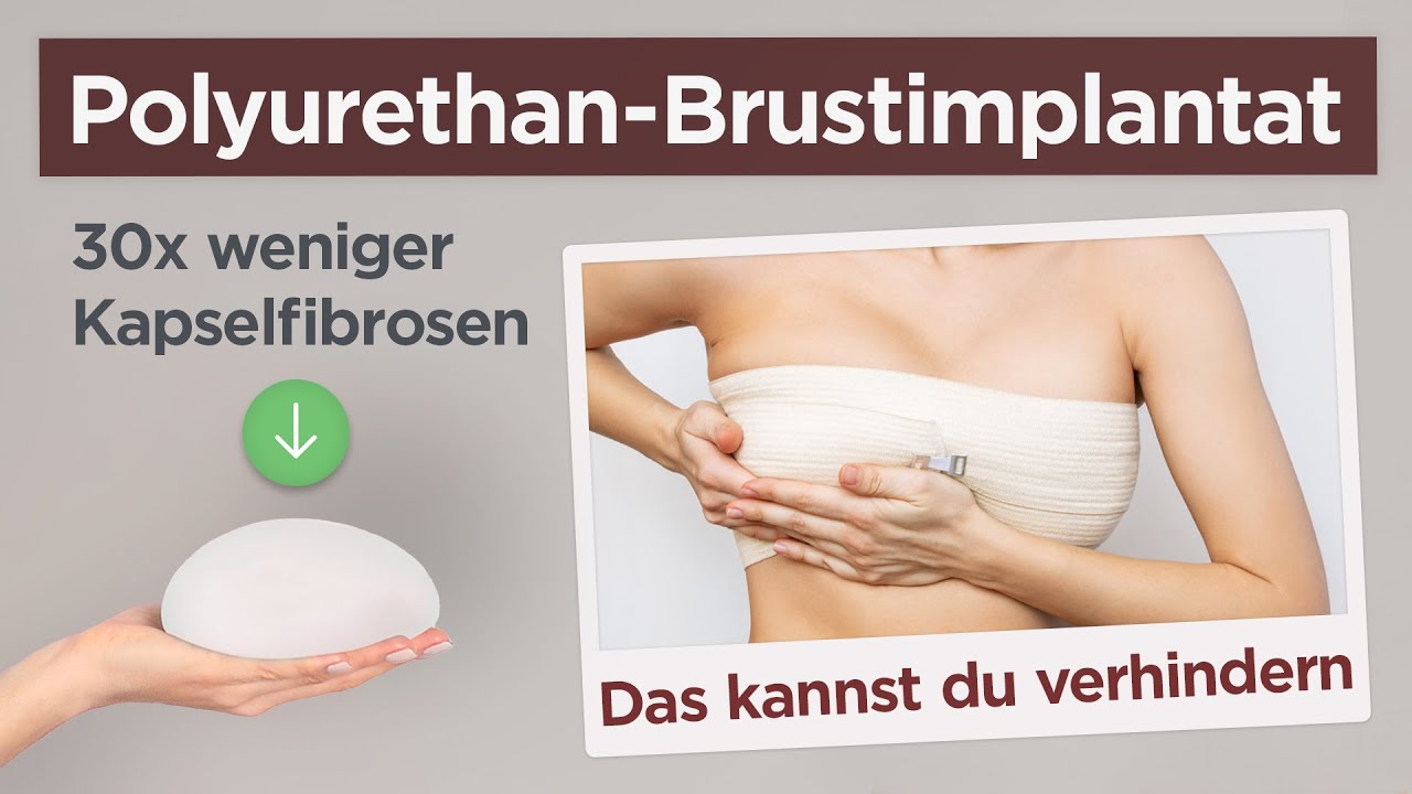 Dieses Brustimplantat verhindert Kapselfibrosen