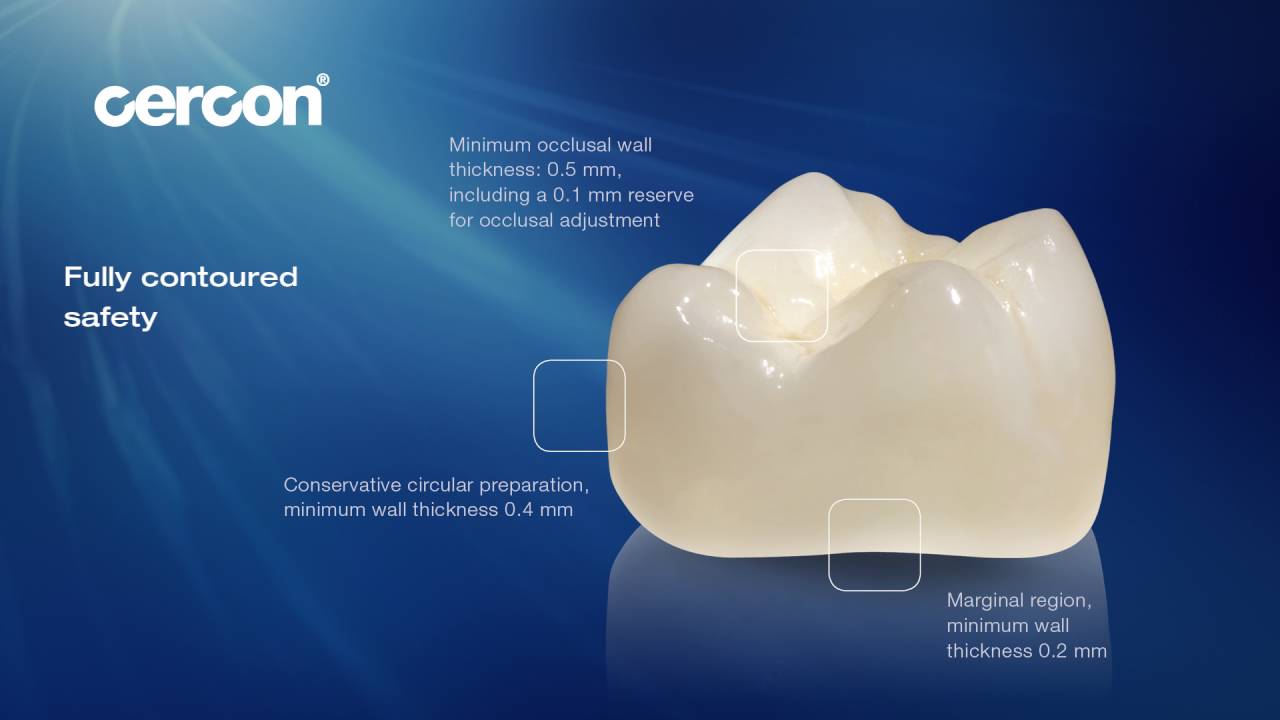 Dentsply Sirona Cercon