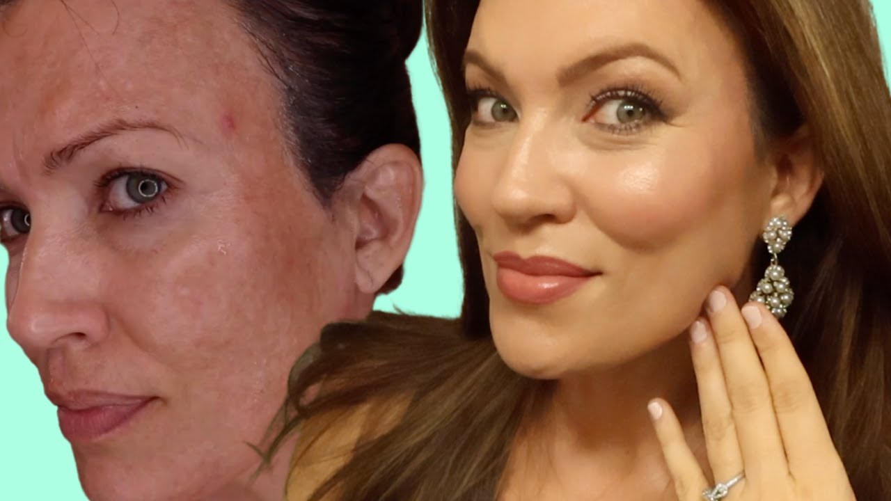 MELASMA ❌ NEVER DO THESE 10 THINGS IF YOU HAVE MELASMA!!!