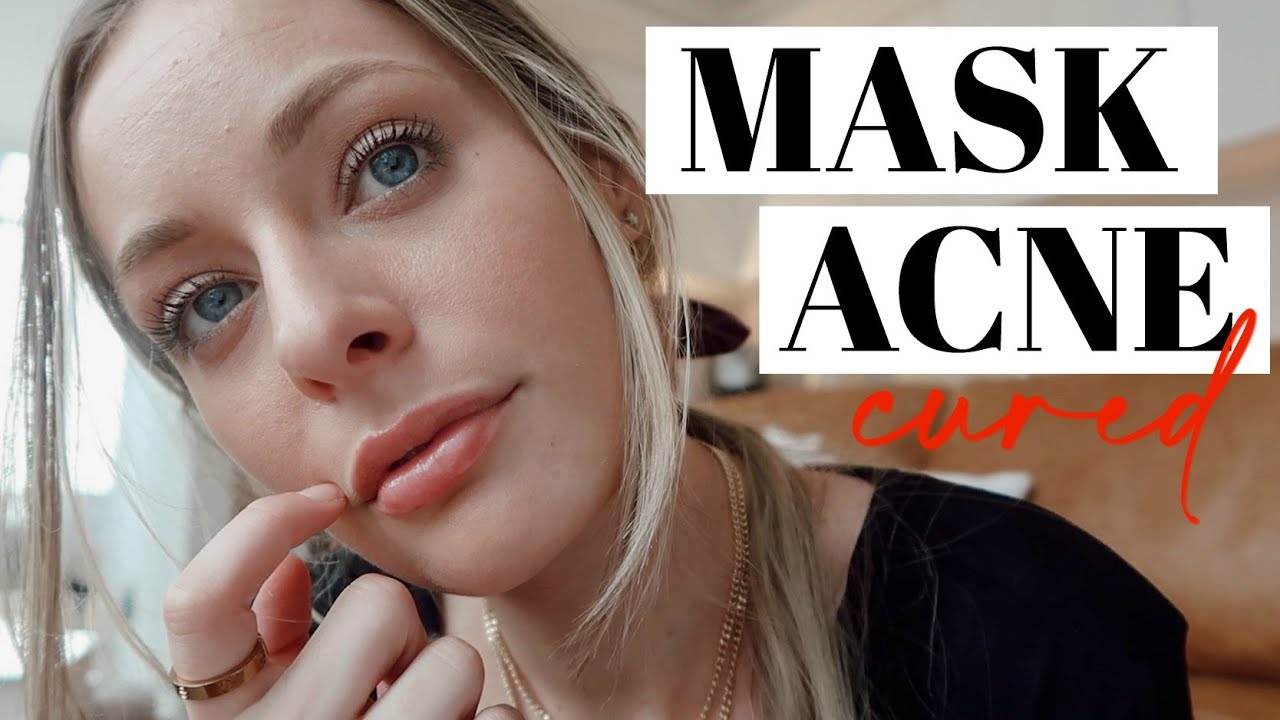 how I cleared my MASK ACNE in 5 days