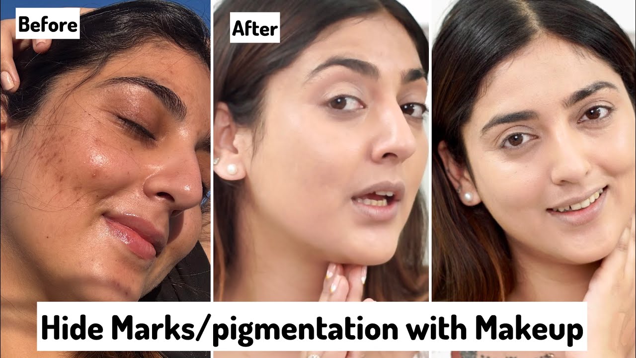 Hide Marks/ pigmentation with Makeup | only 2 steps(100% Works)