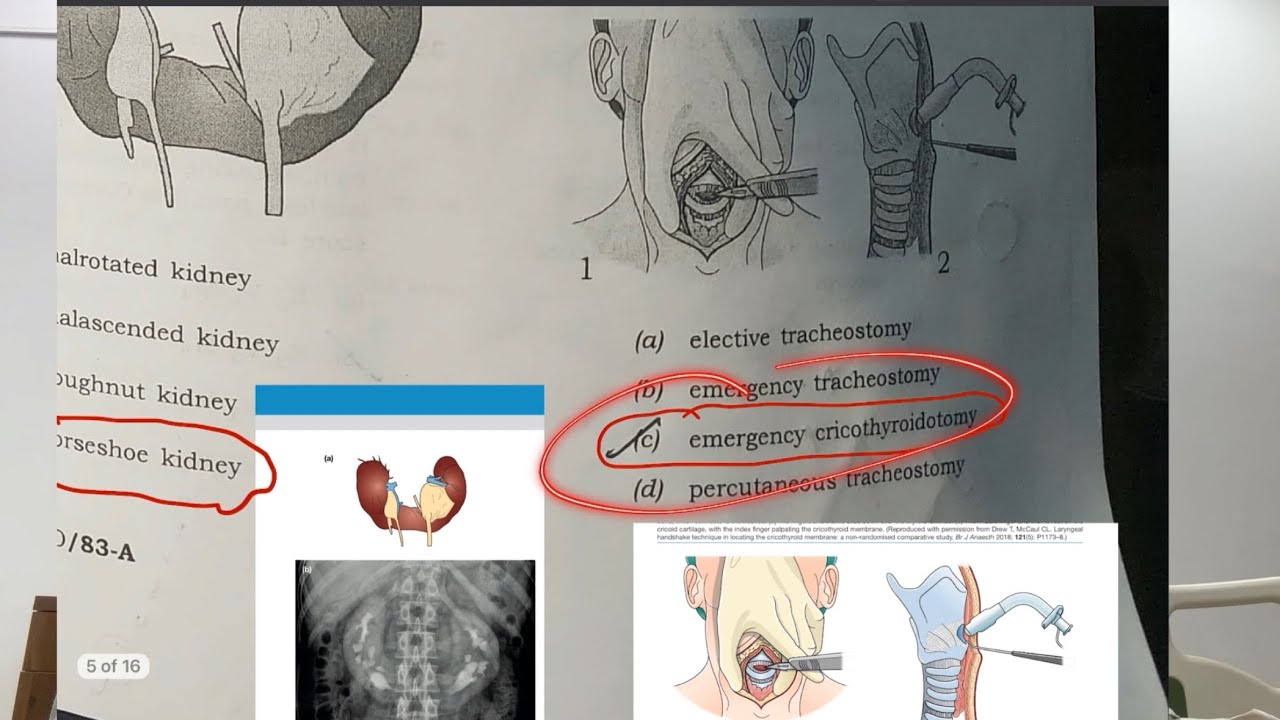 UPSC CMS 2026 Paper 2 Set A SOLVED with TEXTBOOK REFERENCE and EXPECTED CUTOFF🔥