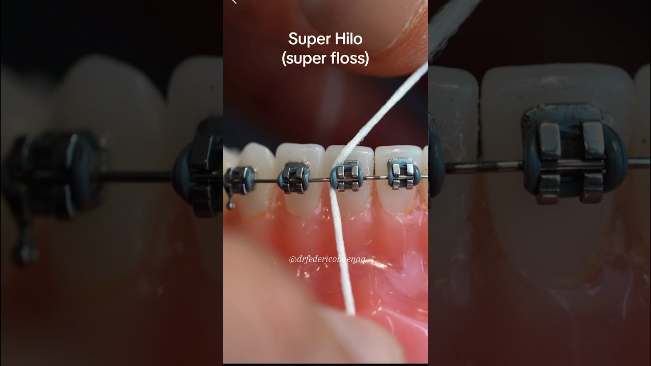 As&iacute; se usa el hilo dental con brackets 😲