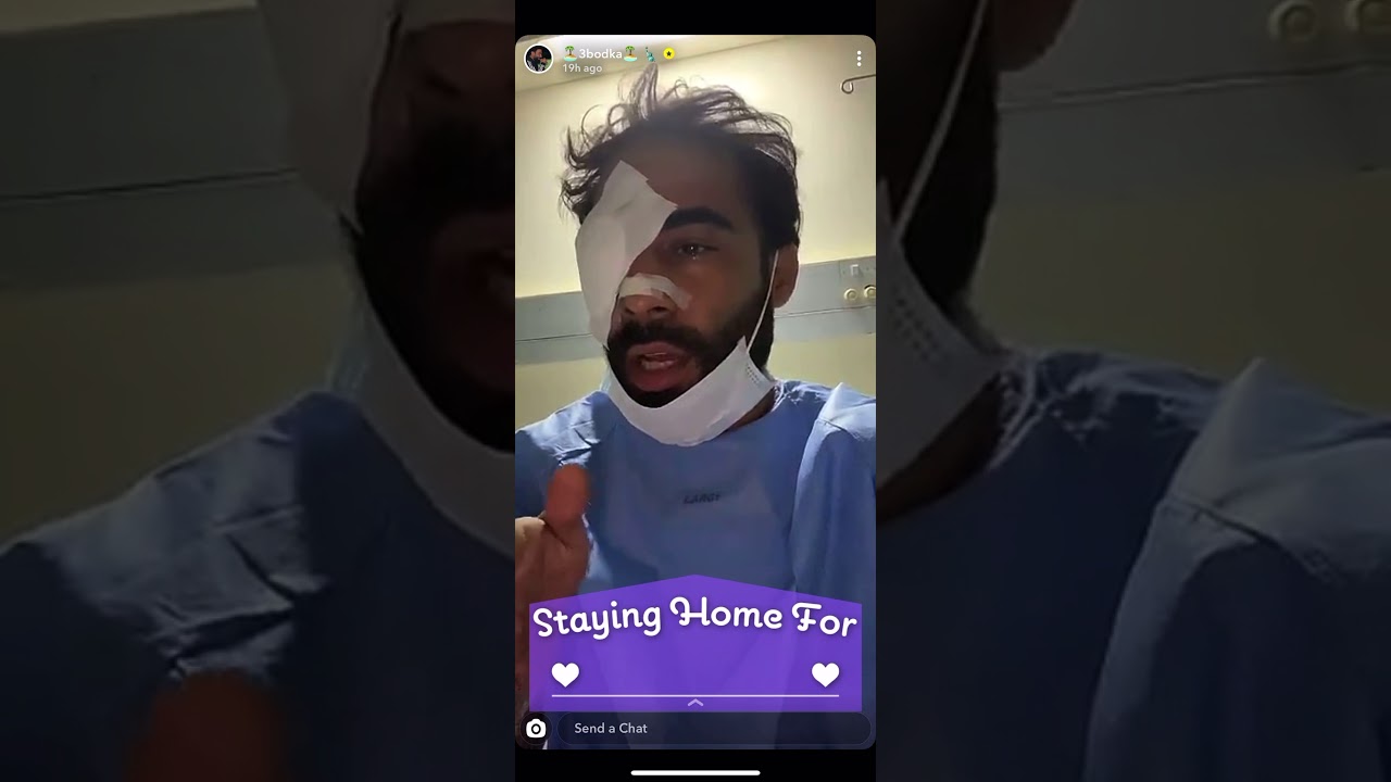 سنابات عبودكا | عبودكا يقول قصة اللي ضربوه بالتفصيل ويتوعدهم اذا طلع من المستشفى بياخذ حقه ! 😱😱