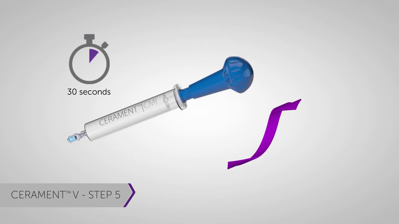 CERAMENT®  V second generation mixing instructions